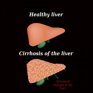 Liver Test Image